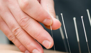 Acupuncture treatment to help with symptoms of Cancer Pain